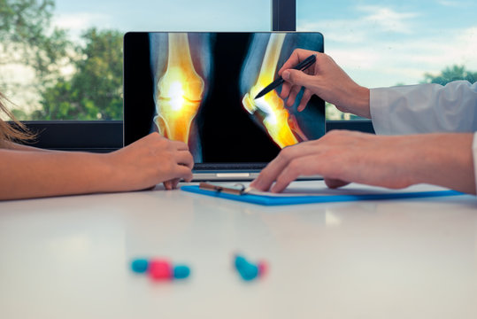 Doctor showing a x-ray of legs with pain in the bones on a laptop to a woman patient. Pills on the desk