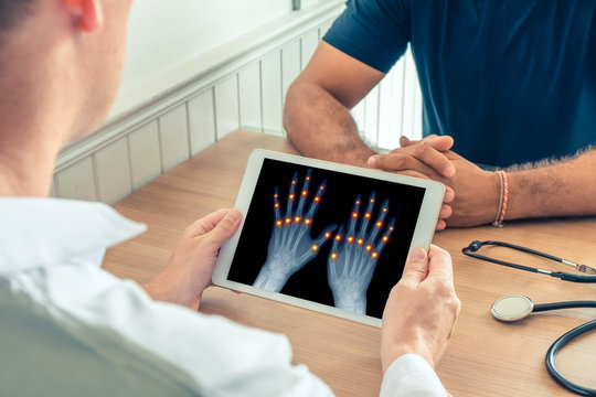 Doctor holding a digital tablet with x-ray of hands of the patient. Pain on the joints of the fingers. Osteoarthritis concept