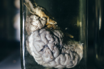 Reserved animal brain in liquid formaldehyde in glass jar in scientific veterinary laboratory