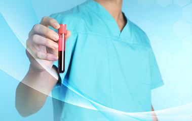 Male doctor holding test tube with blood sample on color background, closeup. Medical object