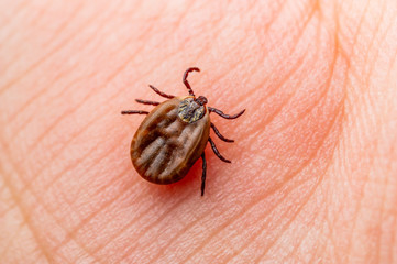 Encephalitis Virus or Lyme Borreliosis Disease Infectious Dermacentor Tick Arachnid Parasite Insect on Skin Macro