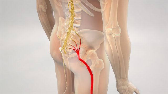 Sciatic Pinched Nerve Pain 3D Render