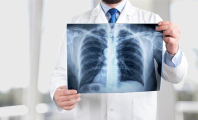 Young man doctor holding x-ray