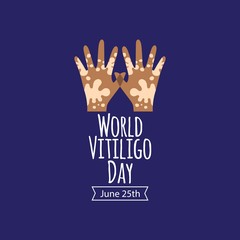 Fototapeta na wymiar World vitiligo day vector template. Design for banner, greeting cars or print.