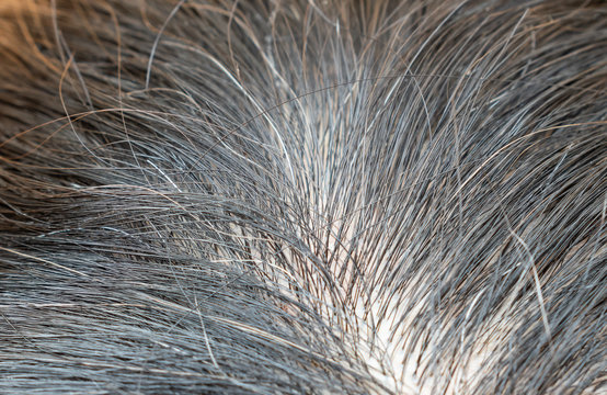 Close Up Black Hair And Gray Hair On Scalp.