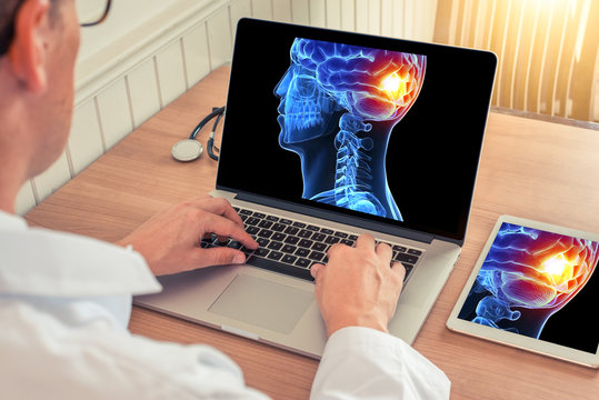 Doctor watching a laptop with x-ray of a 3D skull head with pain relief in the back of the brain and digital tablet in office. 