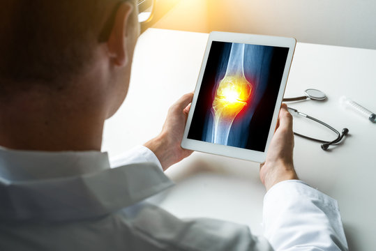 Doctor holding a digital tablet with x-ray of leg with pain on the joint of knee