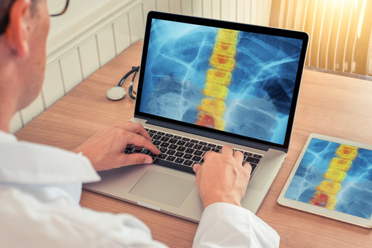 Doctor watching a laptop and digital tablet with x-ray of chest with pain relief on the spine in a medical office