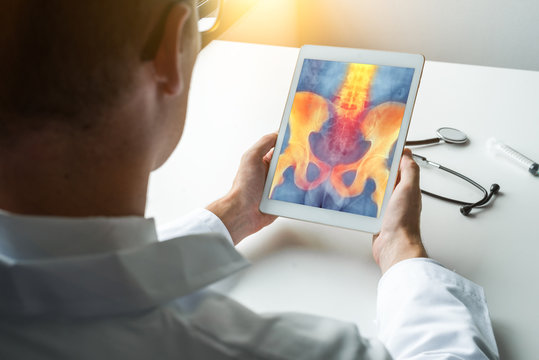 Doctor holding a digital tablet with x-ray of hips