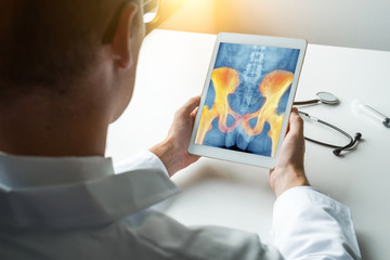 Doctor holding a digital tablet with x-ray of pain on the hips