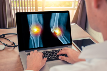 Doctor watching a laptop with x-ray of legs with pain in the knee. Radiology concept