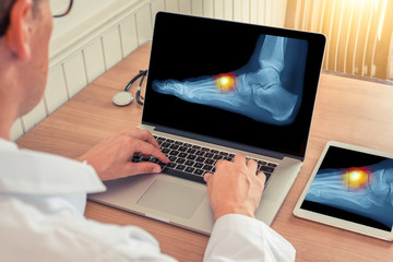 Doctor watching a laptop with x-ray of pain relief on the top of a foot in a medical office