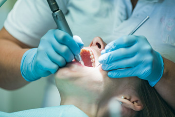 Young girl getting dental treatment. Overview of dental caries prevention. A girl at the dentist's...