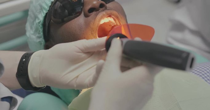 dentist uses ultraviolet filling for black client.