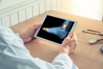 Doctor holding a digital tablet with x-ray and pain on the ankle and toes of the foot
