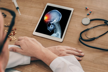 Doctor watching a digital tablet with x-ray of skull with pain in the front of the head. Migraine headache or trauma concept