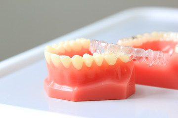 front view of complete denture