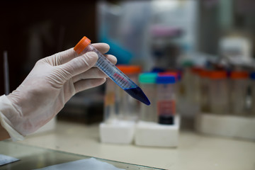 lab technician assistant analyzing a blood sample in test tube at laboratory.