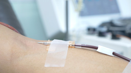 Blood donation or transfusion .