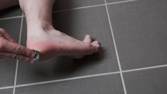 Man removing corn, callus from his feet using a razor file, masculine skin care, skin disease, fungal infection, skin treatment
