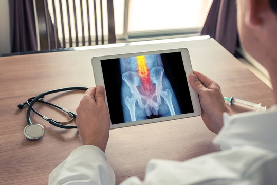 Doctor holding a digital tablet with x-ray of hips and pain on a spine