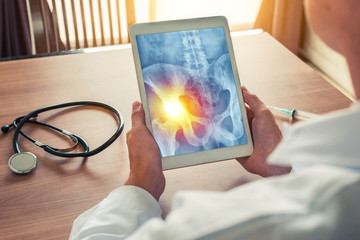 Doctor holding a digital tablet with x-ray of hips with pain on the left. Stethoscope and syringe on the desk