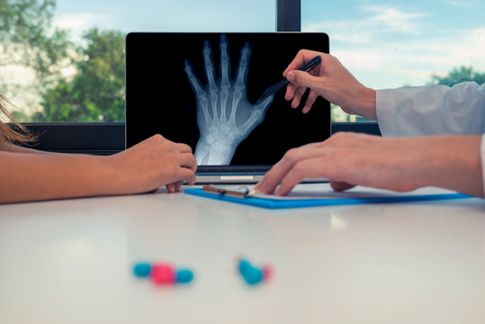 Doctor showing a x-ray of a left hand on a laptop to a woman patient. Osteoarthritis concept