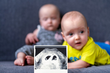 Photo ultrasound twins. In the background are twins, a boy and a girl of 7 months. Maternity. Selective focus.