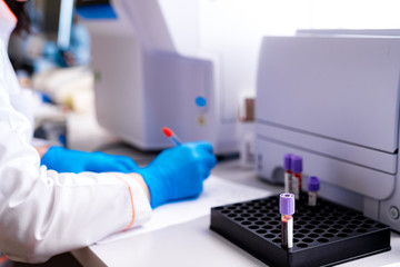Close-up of female hands filling the tube with blood from the automated machine. Technician uses laboratory equipment while working with samples in tubes indoors.