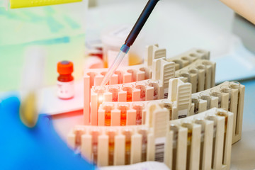 Professional laboratory workers pouring blood samples into vials on the table. Medical laboratory technicians making blood experiments in research clinic.