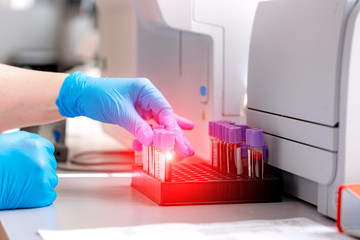 Close-up of female hands filling the tube with blood from the automated machine. Technician uses...