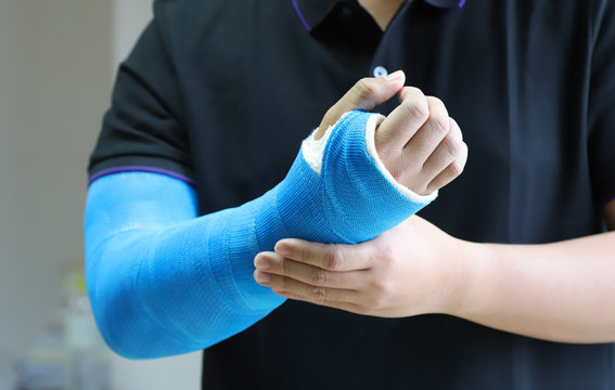 Closeup of asian man's arm with long arm plaster, fiberglass cast therapy cover by blue elastic bandage after sport injury. 