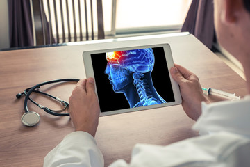 Fototapeta premium Doctor holding a digital tablet with x-ray of 3D head and pain in the front of brain. Migraine and headache concept