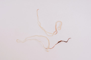 Dental floss with blood on a white background. Periodontal disease in an adult. Diseases of the...