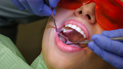 Dentist does routine inspection of teeth and gums. Girl patient in dental clinic. Close-up.