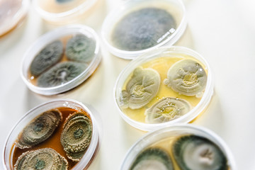 Valencia, Spain - May 25, 2019: Samples in petri dishes of different types of fungi and bacteria to analyze contaminated water and food in a laboratory.