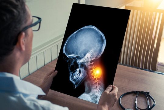 Doctor holding a x-ray of skull head in with pain on the neck in medical office