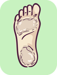 Foot Symptom Thicken Skin Illustration