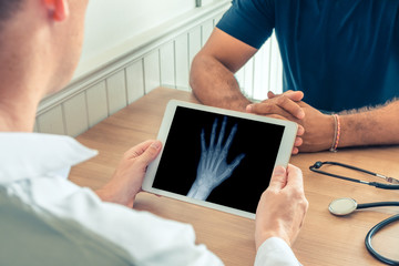 Obraz na płótnie Canvas Doctor holding a digital tablet with x-ray of left hand of the patient. Osteoarthritis concept