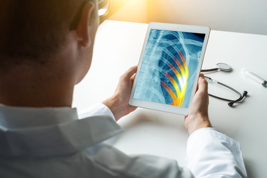Doctor holding a digital tablet with x-ray of chest. Pain on the ribs