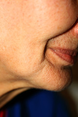 Sunken cheeks. Nasolabial folds on face. Wrinkles.