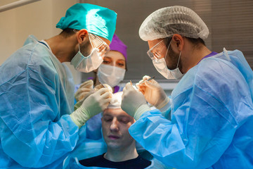 Baldness treatment. Hair transplant. Surgeons in the operating room carry out hair transplant surgery. Surgical technique that moves hair follicles from a part of the head.