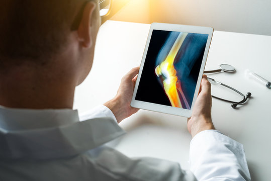 Doctor holding a digital tablet with x-ray of pain on a knee. Side view