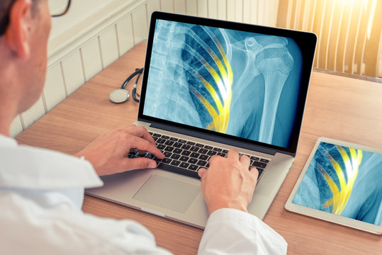 Doctor watching a laptop and digital tablet with x-ray of chest with pain relief in the ribs in a medical office