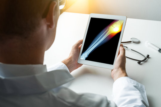 Doctor holding a digital tablet with x-ray of leg with pain on the knee