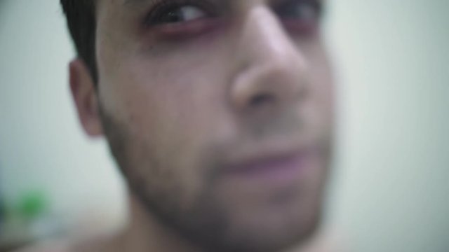 Paranoid drug junkie is experiencing hallucinations and paranoia