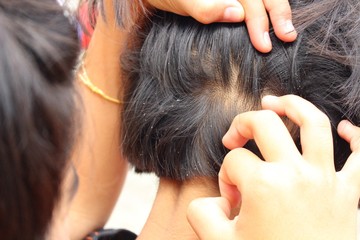 Fototapeta premium Girls lice on the head, filmed as blurred images