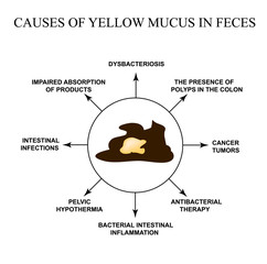 Causes of yellow mucus in feces. Diseases of the gastrointestinal tract. Infographics. Vector illustration on isolated background.