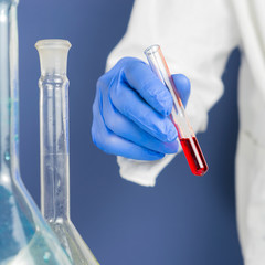 Hand of a doctor holding a bottle of blood sample