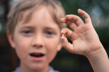 6 years old boy shows the ruptured milk tooth